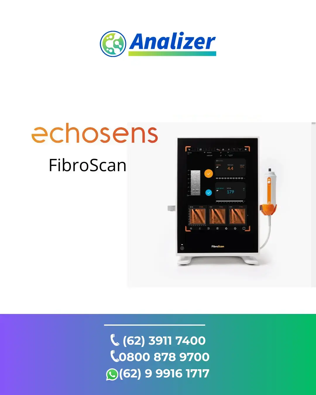 REPARO ECHOSENS FIBROSCAN CEARÁ